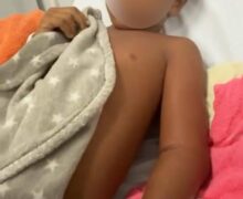 Ataque de cobra deixa criança de 5 anos ferida em área de garimpo