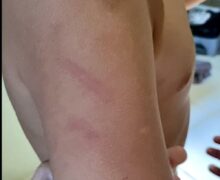 Criança chora e diz ter sido agredida por professora; mãe faz desabafo