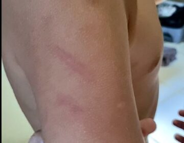 Criança chora e diz ter sido agredida por professora; mãe faz desabafo