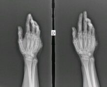 Juiz proíbe prefeitura de demitir servidora baleada por ex-companheiro policial