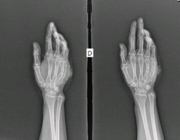 Juiz proíbe prefeitura de demitir servidora baleada por ex-companheiro policial