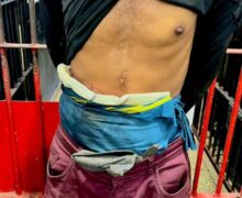 Detento usando bolsa de colostomia é flagrado com drogas durante abordagem da PM em Macapá