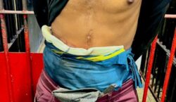 Detento usando bolsa de colostomia é flagrado com drogas durante abordagem da PM em Macapá