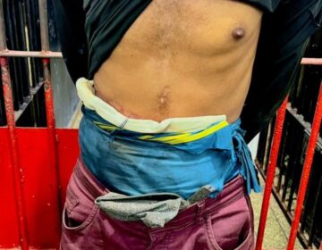 Detento usando bolsa de colostomia é flagrado com drogas durante abordagem da PM em Macapá