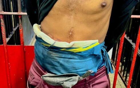 Detento usando bolsa de colostomia é flagrado com drogas durante abordagem da PM em Macapá