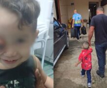 Câncer faz olho de menino de 2 anos saltar do rosto; ONG consegue tratamento em SP