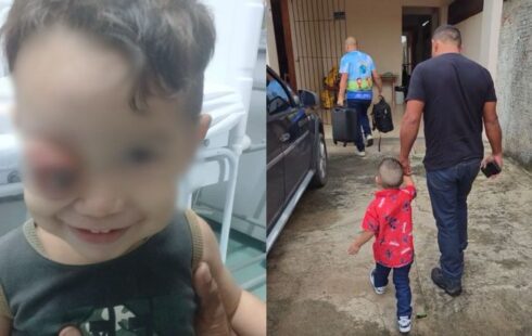 Câncer faz olho de menino de 2 anos saltar do rosto; ONG consegue tratamento em SP
