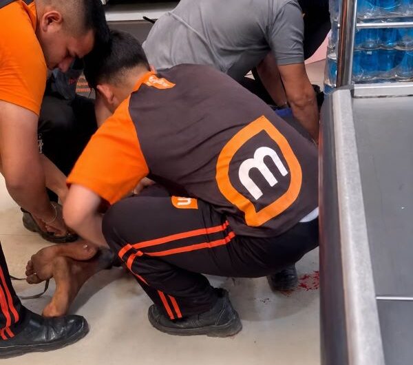 Jovem em surto morreu por asfixia durante imobilização dentro de atacarejo, diz laudo