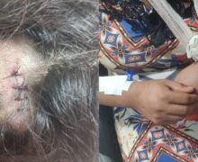 “Não deixa ele me matar”: mulher foge nua e ensanguentada após uma semana de agressões do marido