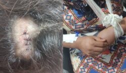 “Não deixa ele me matar”: mulher foge nua e ensanguentada após uma semana de agressões do marido