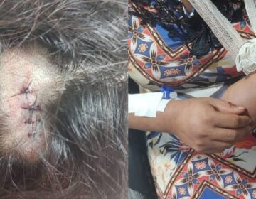 “Não deixa ele me matar”: mulher foge nua e ensanguentada após uma semana de agressões do marido